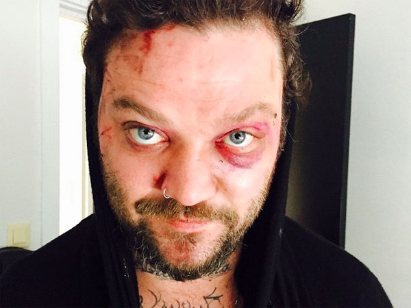 Bam Margera everything-pr
